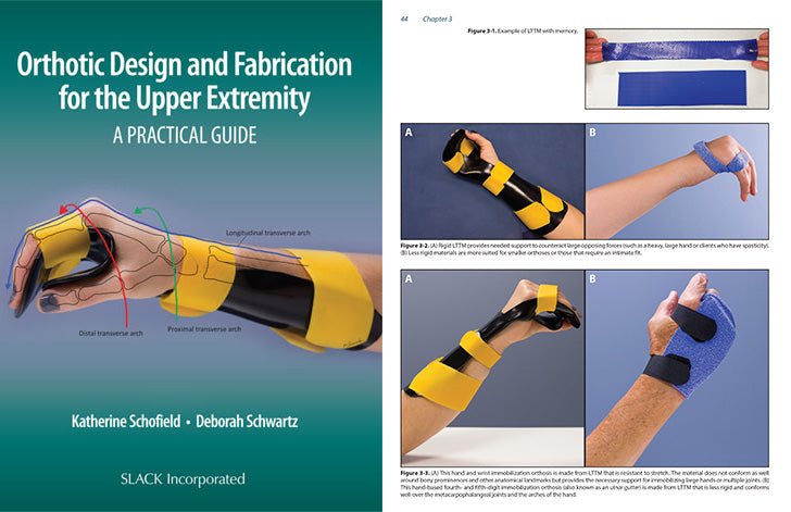 Orthotic Design and Fabrication for the Upper Extremity – WS Medical ...